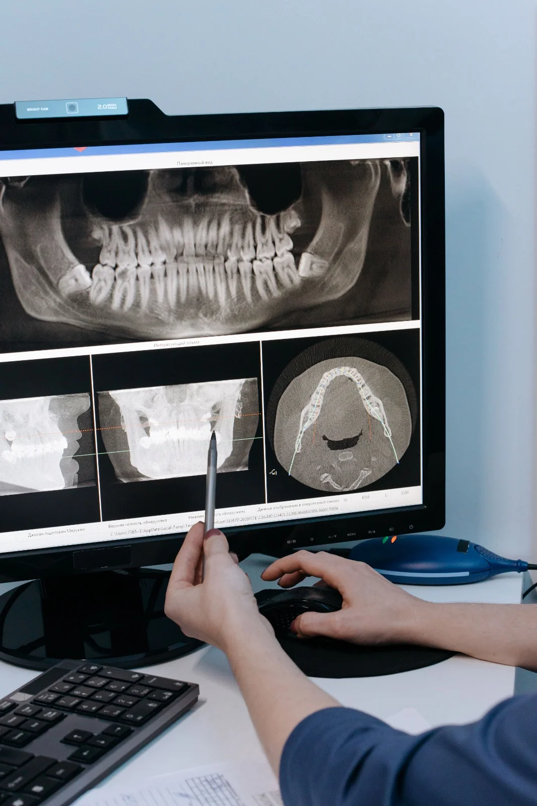 Dental x-ray imaging screen used for clinical planning